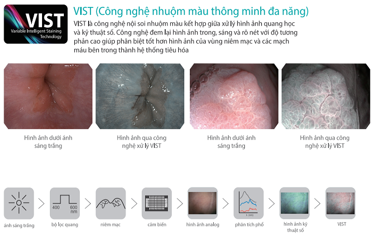 Hệ thống nội soi tiêu hóa HD-550